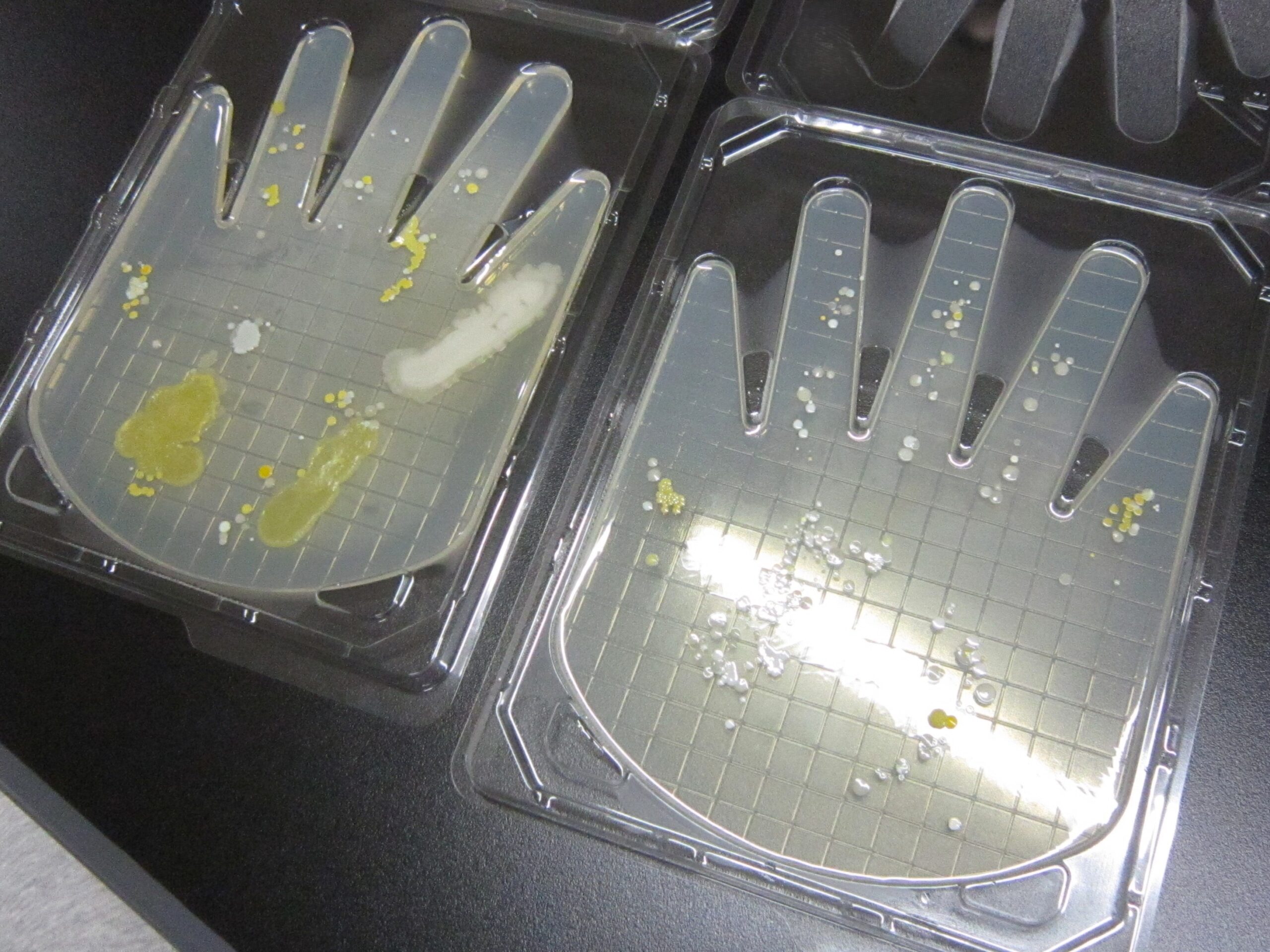 「培養の準備」